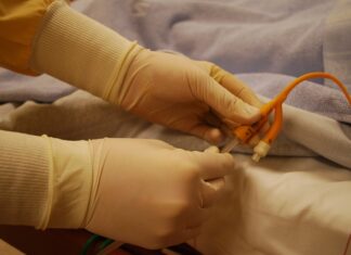 Po jakim czasie usuwa się cewnik?