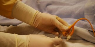 Jak długo może być podłączony cewnik?